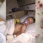 advarsel-om-vannkopper