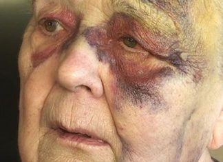 82-åringen har blitt fanget i sitt eget hjem. Hun klarer ikke gå ut på egenhånd og får ikke hjelp.