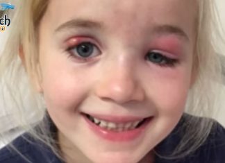 Legene mener at datteren kun har øyebetennelse – Moren mistenker noe helt annet!