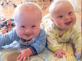 Disse tvillingene med downs syndrom sjarmerer og inspirer folk i hele verden!