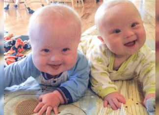 Disse tvillingene med downs syndrom sjarmerer og inspirer folk i hele verden!
